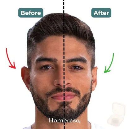 Invisible Ear Corrector – Instant results