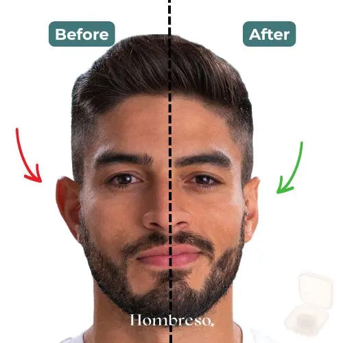 Invisible Ear Corrector – Instant results