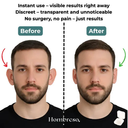 Invisible Ear Corrector – Instant results
