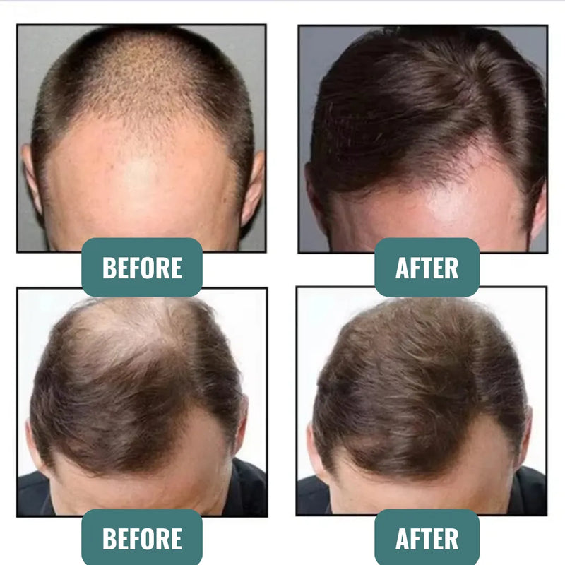 Instant Keratin Hair Fiber - Thicker Hair in Seconds