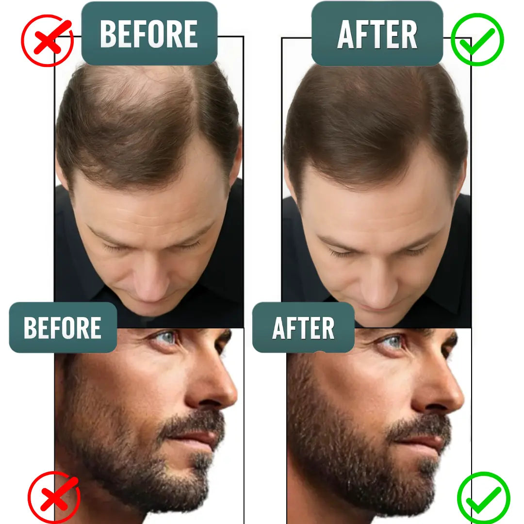 Instant Transformation – Beard & Hair